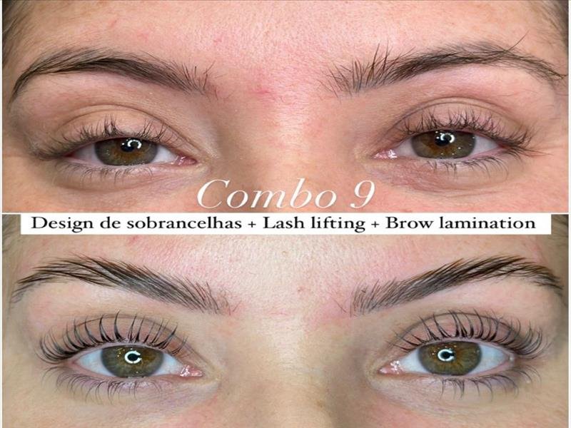COMBOS DE ESTÉTICA