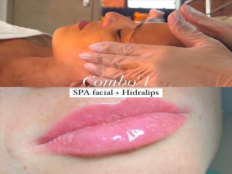 COMBOS DE ESTÉTICA